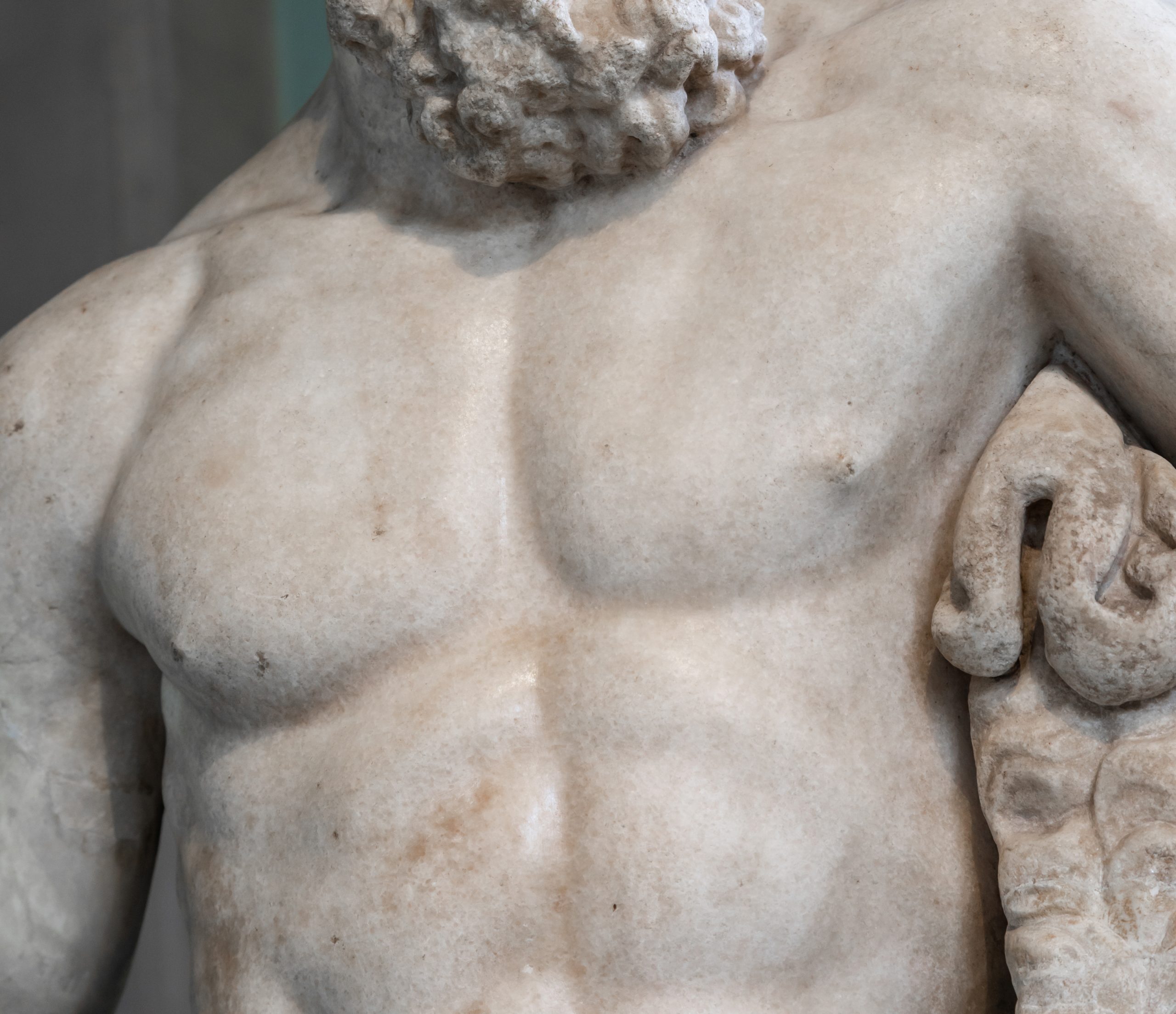 Learn about Male Chest Reduction procedures at Fitzwilliam Clinic